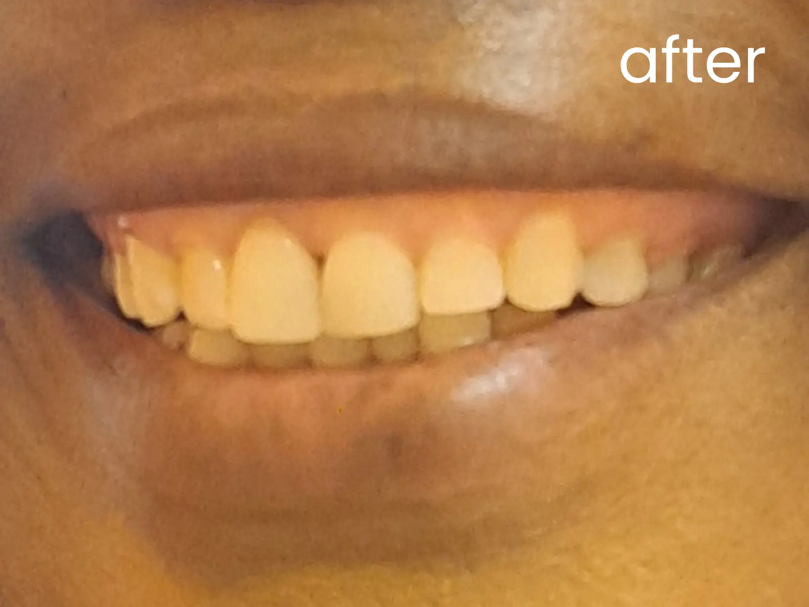 After image