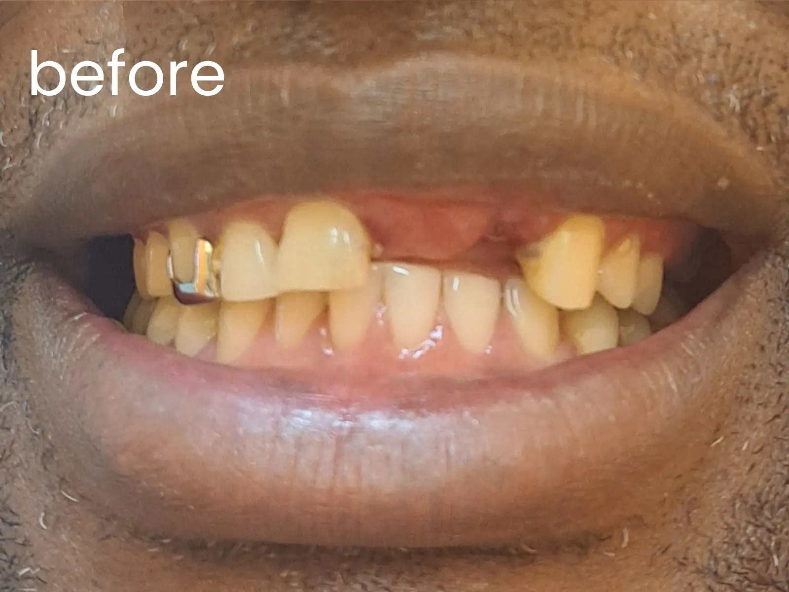 Before image